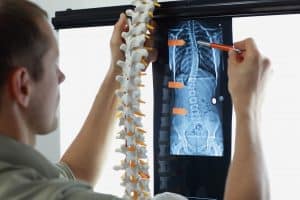 Common Back and Spine Injuries Caused by Negligence
